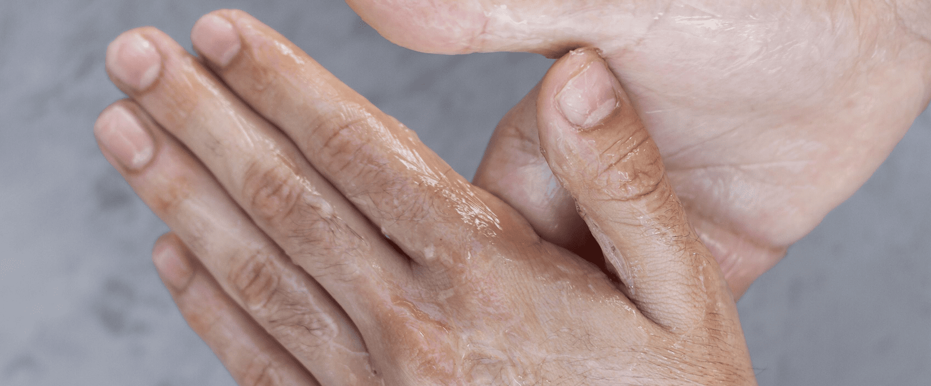 scleroderma-diagnoses-and-tests