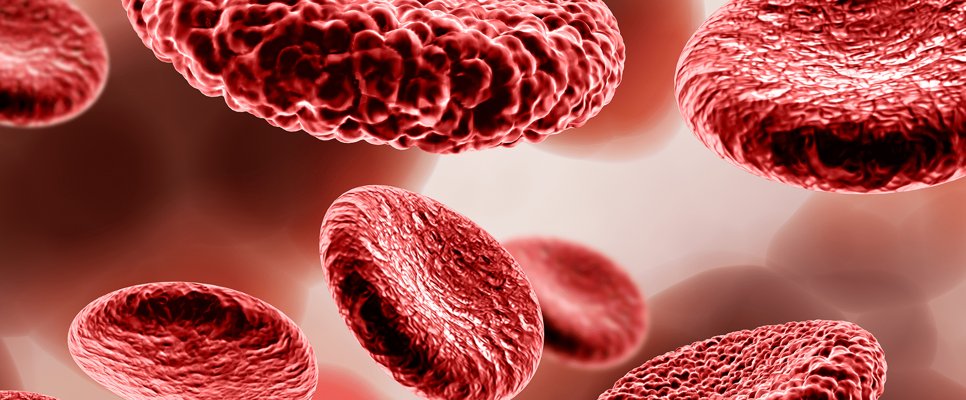 antiphospholipid-syndrome-and-its-diagnosis